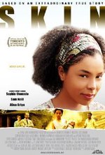 Watch Skin - In schwarzer Haut kostenlos online. Skin - In schwarzer Haut poster